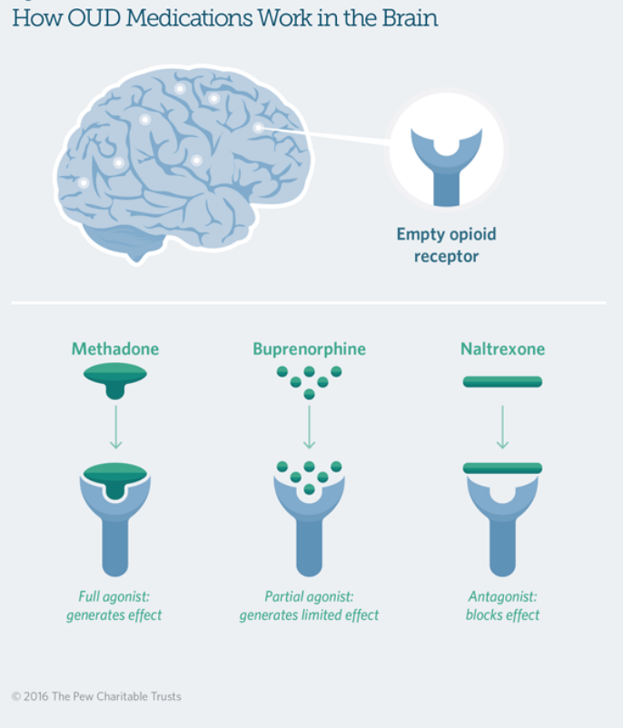 How opioids work on brain receptors 